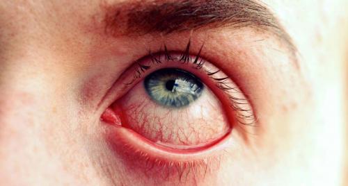 Могут ли эмоции вызывать слезотечение